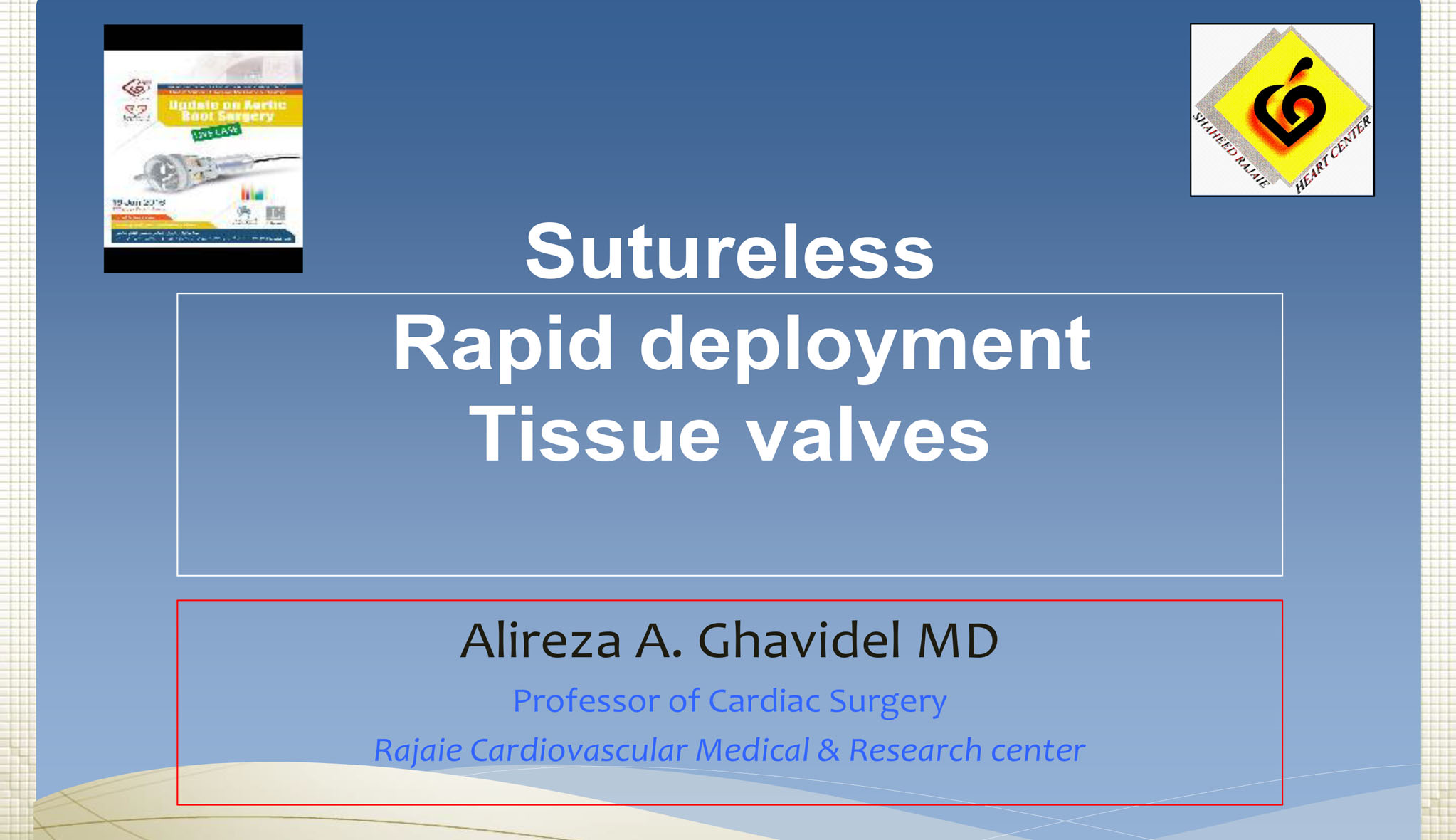 Sutureless Rapid deployment Tissue valves