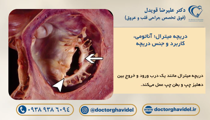 تصویر دریچه میترال قلب