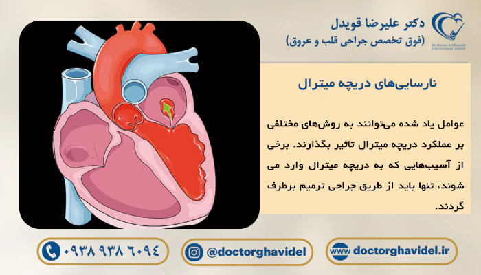 تصویر گرافیکی نارسایی دریچه میترال