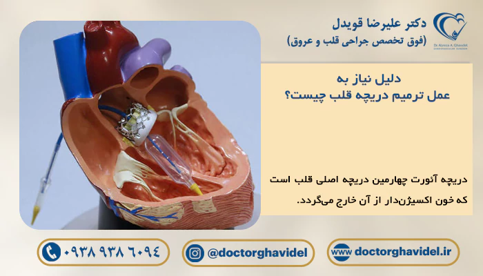 دلیل نیاز به عمل ترمیم دریچه قلب چیست؟