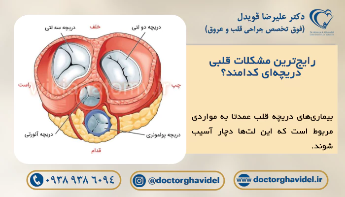 تصویر دریچه‌های قلبی