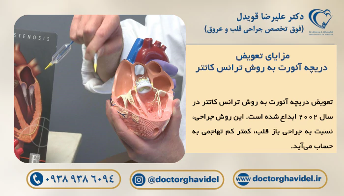 پزشک در حال نشان دادن ماکت عمل تعویض دریچه آئورت به روش ترانس کاتتر