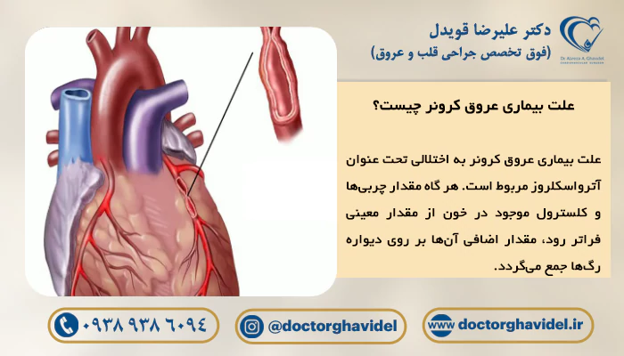 علت بیماری عروق کرونر قلب چیست؟
