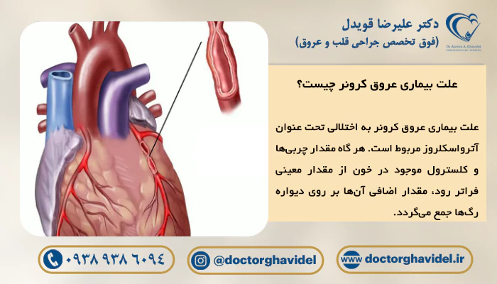 تصویر بیماری در عروق کرونر قلب 