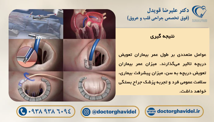 تصاویر عمل تعویض دریچه قلب که شیوه انجام آن بر میزان عمر بیماران تعویض دریچه قلب موثر است.