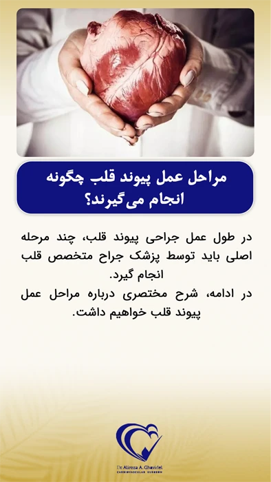 قلب در دست پزشک در عمل پیوند قلب 