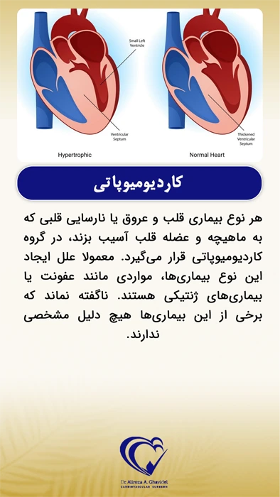 تصویر قلب سالم و مقایسه آن با قلب هیپرتروفیک 