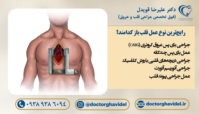 رایج‌ترین نوع عمل قلب باز کدامند؟