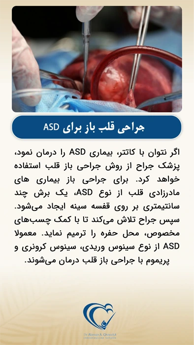 جراحی قلب باز برای ASD