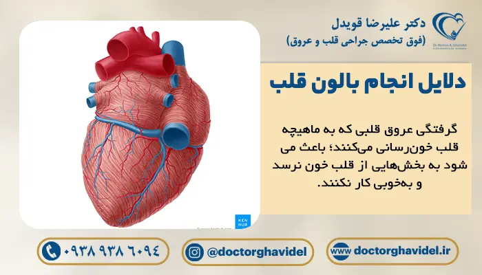 تصویر گرافیکی قلب و عروق قلبی