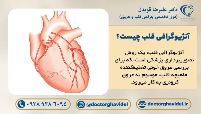 تصویر انیمیشن مشاهده رگهای قلب پس از آنژیوگرافی قلب 