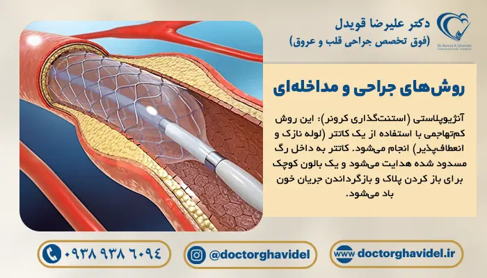 آنژیوپلاستی و جراحی بای پس عروق کرونر، روش های جراحی کلسیم عروق کرونر هستند.