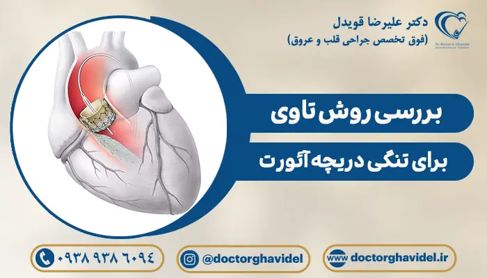 کاشت دریچه قلب با عمل تاوی قلب | روش TAVI