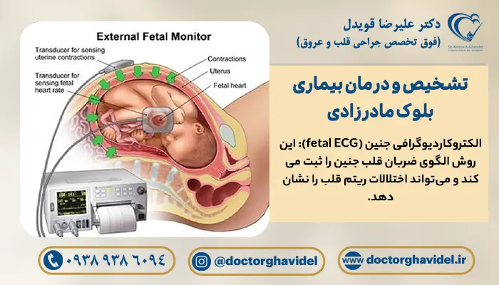 انجام الکتروکاردیوگرافی جنین برای تشخیص بلوک قلبی مادرزادی 