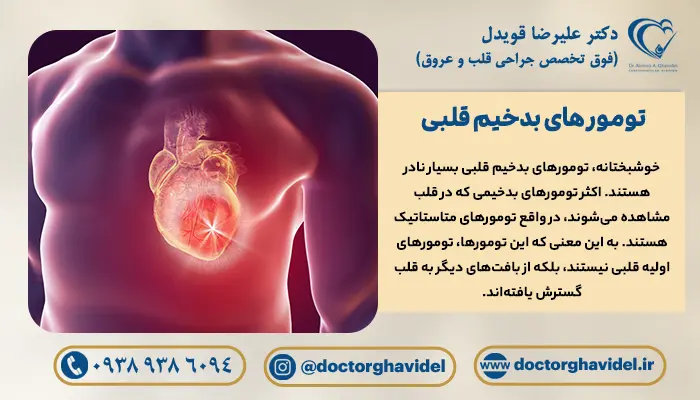 تصویر گرافیکی قلبی که تومور قلبی بدخیم دارد.