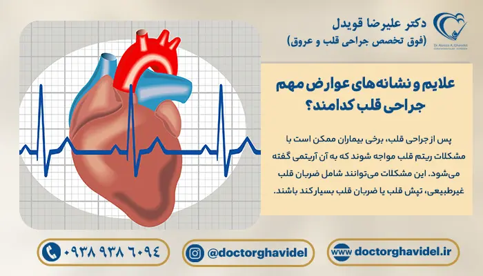 تصویر گرافیکی آریتمی قلب، یکی از عوارض انواع عمل قلب