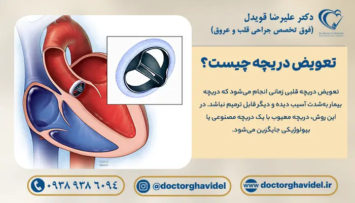 دریچه مصنوعی قلب و تصویر گرافیکی قلب